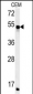 FKBP8 Antibody (Center)